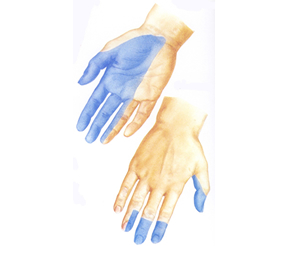右手の正中神経の皮膚神経支配領域