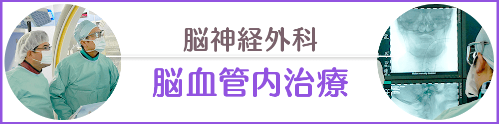 脳神経外科脳血管治療