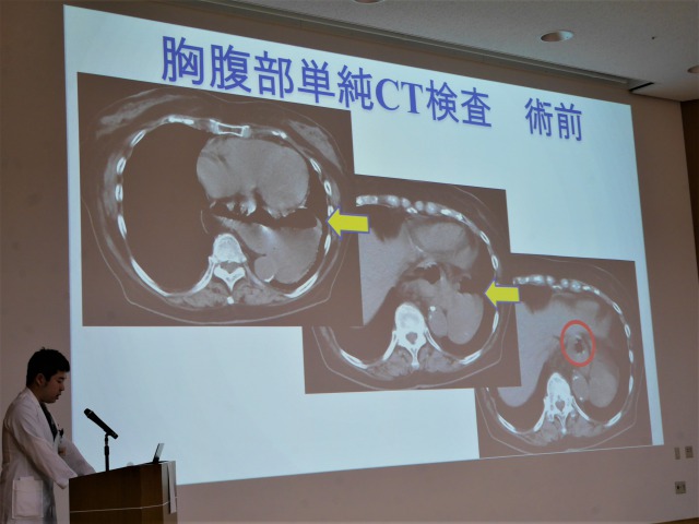 初期研修修了式症例発表