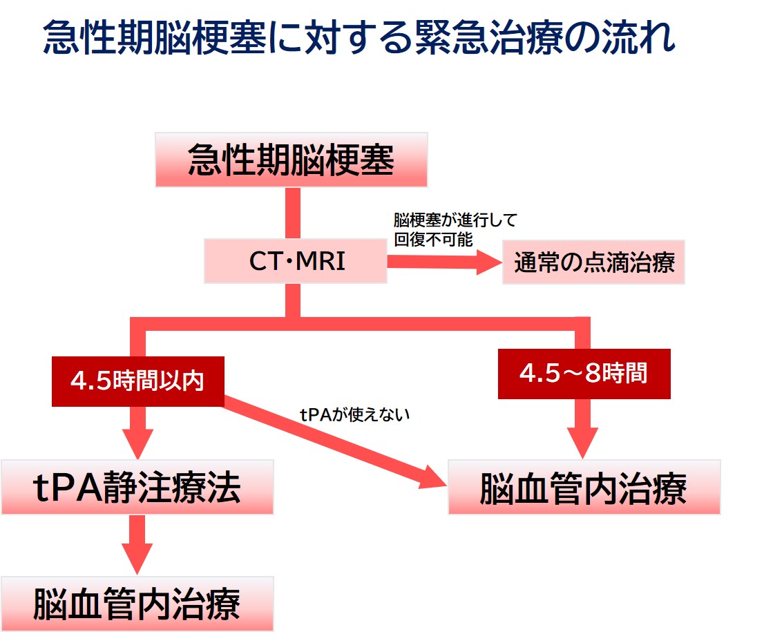 急性期脳梗塞に対する緊急治療の流れ