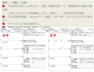 正中神経の神経伝導速度検査所見