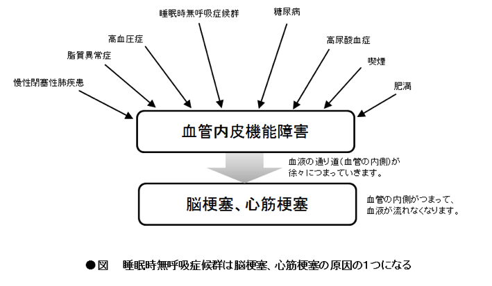 睡眠時無呼吸症候群