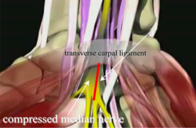 右手の正中神経と手根管の解剖