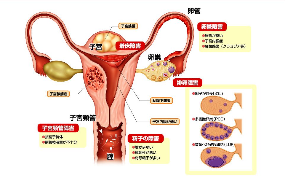 婦人科と泌尿器科の相関図