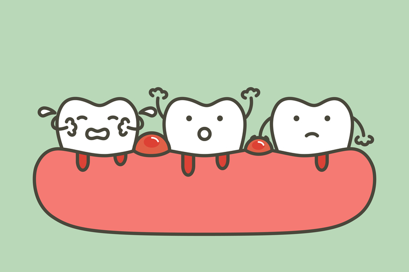 歯周病の歯列イラスト