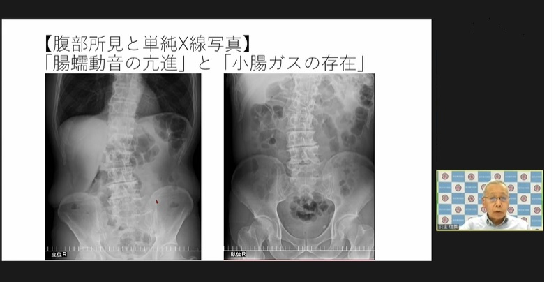 日本平滑筋学会における羽生信義医師の発表